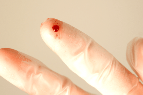 Needlestick OSHA 
